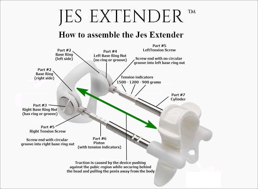 Jes Extender Penis Extender Detailed Review + How To Video - MeVolv