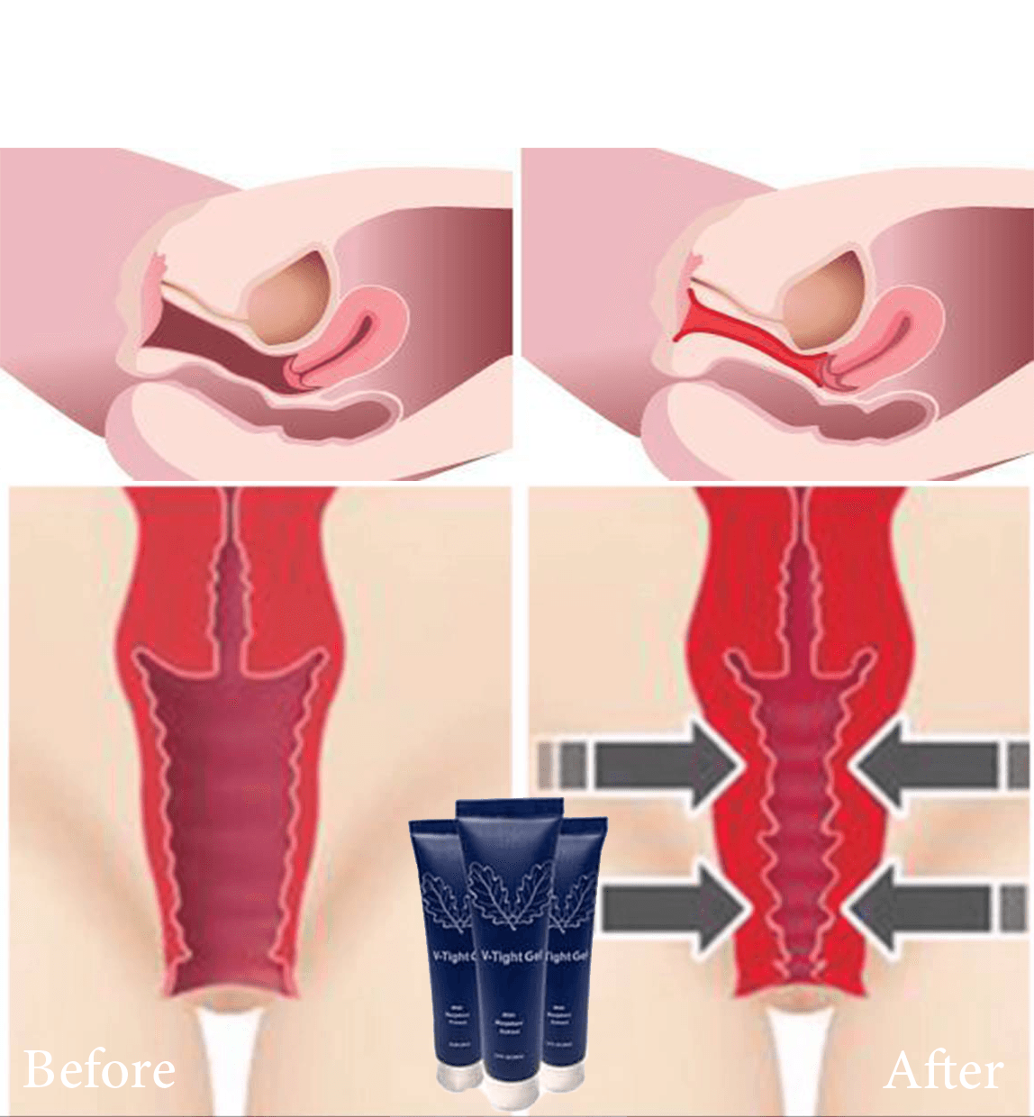 Vaginal Tightening Cream V-Tight Before and After