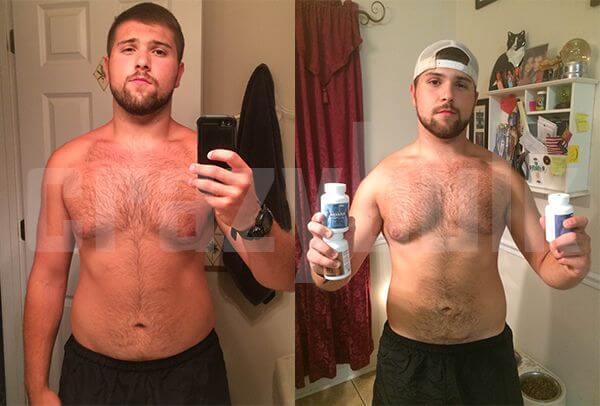 قبل و بعد حرق الدهون انافار